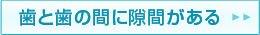 歯と歯の間に隙間がある。