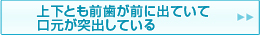 上下ともに前歯が前に出ていて口元が突出している