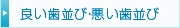 良い歯並び・悪い歯並び